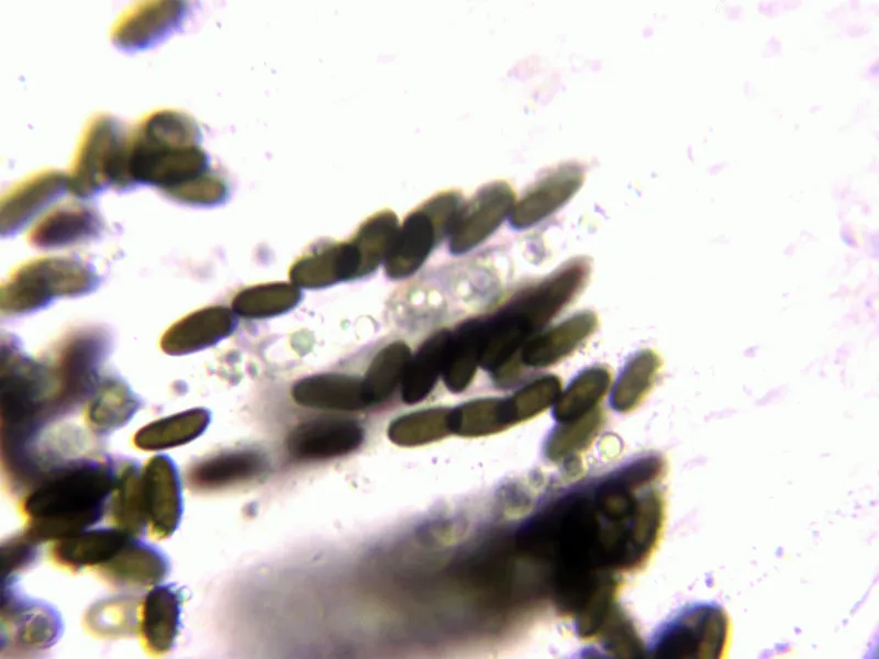 Anthostoma gastrinum 10 - Ascas agua